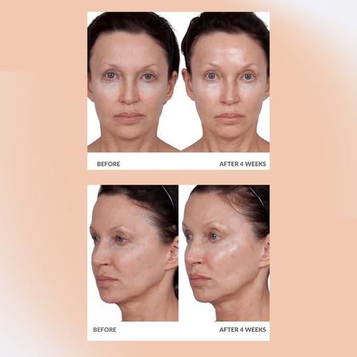 Consult Beaute Volumagen - Collagen Facial Serum Concentrate for Nourishing & Plumping Skin - Hydrates and Temporarily Fills for Smoother, Bouncy Skin - Hyaluronic Acid & Vitamin C - 2 Fl. Oz.